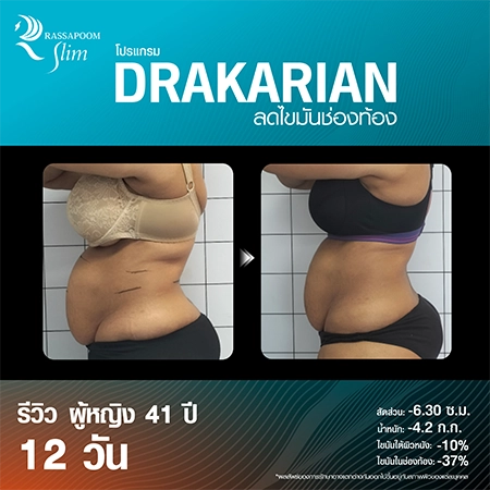 DRAKARIAN breaks down subcutaneous fat.