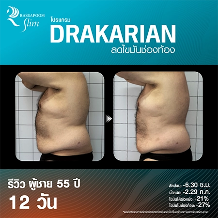 DRAKARIAN breaks down subcutaneous fat.