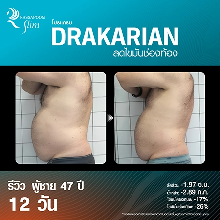 DRAKARIAN breaks down subcutaneous fat.