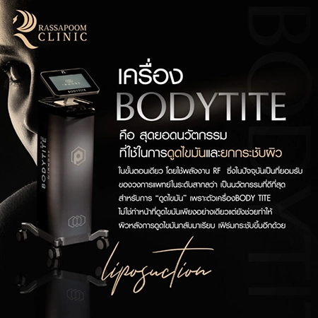 เครื่องดูดไขมัน BodyTite