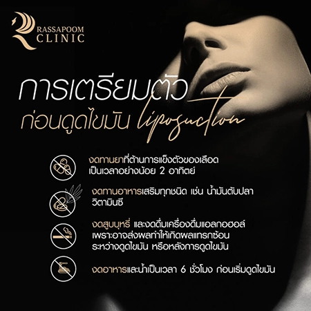 เครื่องดูดไขมัน BodyTite