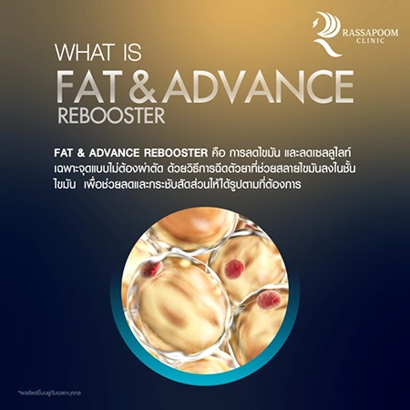 Fat injection to dissolve fat Fat injection to dissolve fat