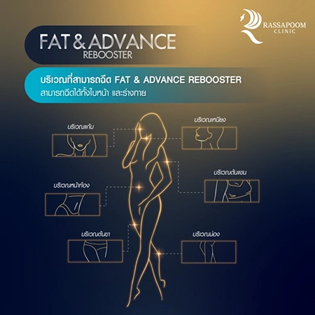 Fat injection to dissolve fat Fat injection to dissolve fat