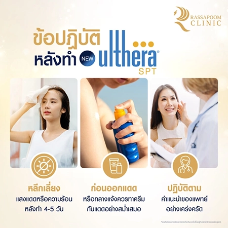 Ulthera ยกกระชับผิว