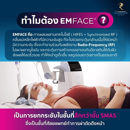 ยกกระชับกล้ามเนื้อ ยกกระชับ EMFACE