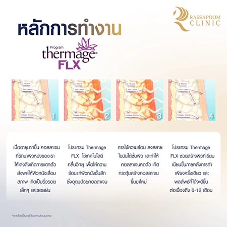 Thermage FLX ยกกระชับ