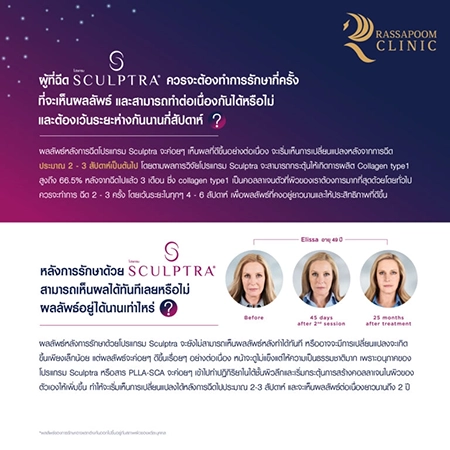 ฉีดกระตุ้นสร้างคอลลาเจน (Sculptra)