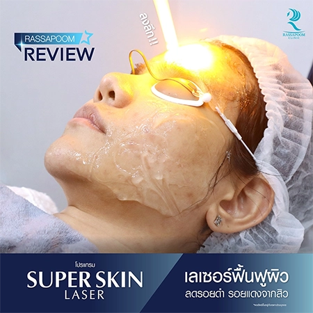 Super Skin Laser คุณปอย กนกนันท์ สุวรรณพฤกษ์