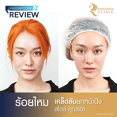 ร้อยไหม คุณรดา ดุษยารินทร์