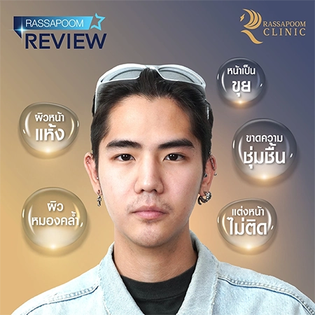 Belotero Revive (คุณนิก คุณาธิป ปิ่นประดับ)