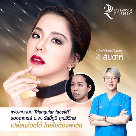 Triangular Face Lift คุณนก วาสนา