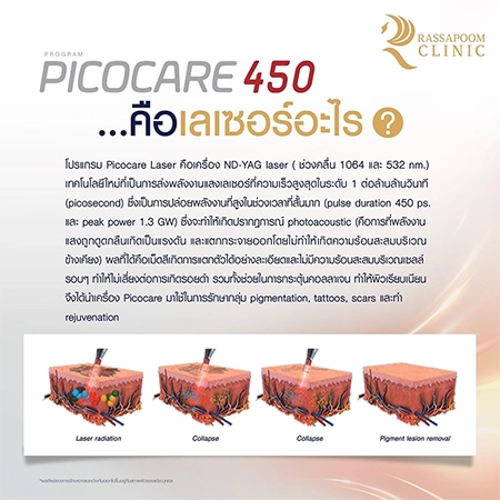 Picocare 450 Laser