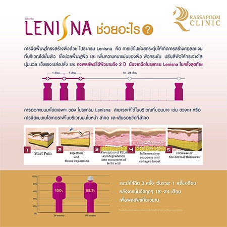 Lenisna