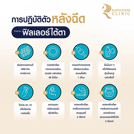 ฉีดฟิลเลอร์ใต้ตา