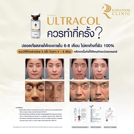 Ultracol ไหมน้ำ