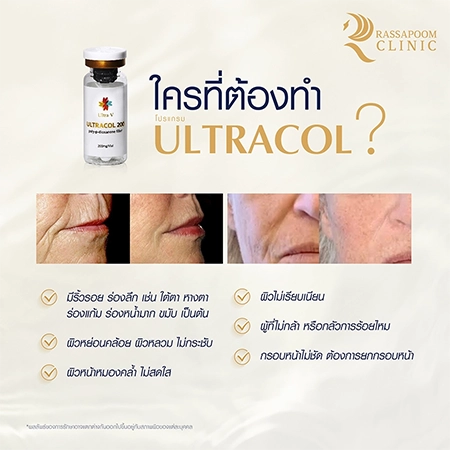 Ultracol ไหมน้ำ