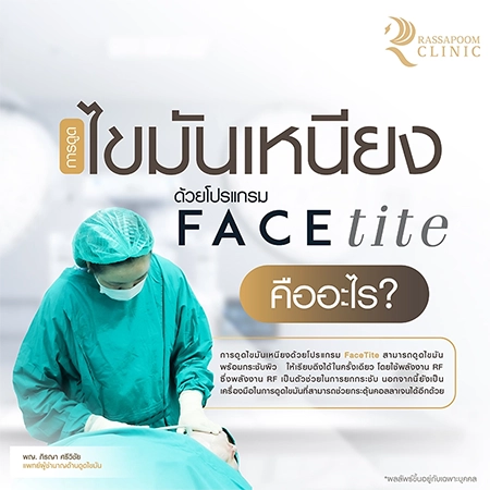 ดูดไขมันเหนียง แก้ปัญหาคางสองชั้น FaceTite AccuTite