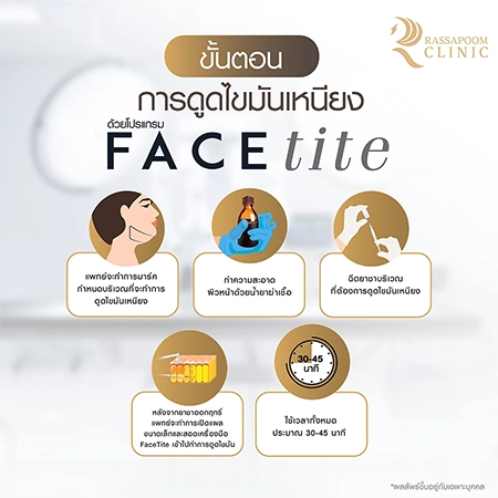 ดูดไขมันเหนียง แก้ปัญหาคางสองชั้น FaceTite AccuTite