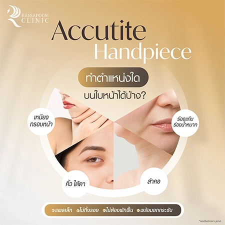 ดูดไขมันเหนียง แก้ปัญหาคางสองชั้น FaceTite AccuTite