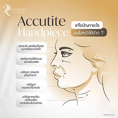 ดูดไขมันเหนียง แก้ปัญหาคางสองชั้น FaceTite AccuTite