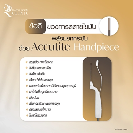 ดูดไขมันเหนียง แก้ปัญหาคางสองชั้น FaceTite AccuTite