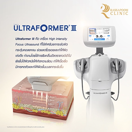 Ultraformer III ยกกระชับ ลดริ้วรอย สลายไขมันใต้ชั้นผิว