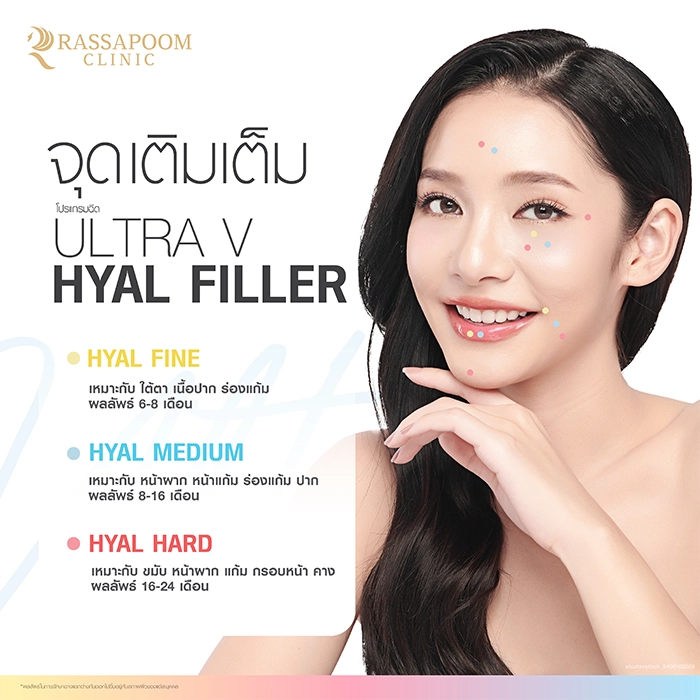 Ultra V Hyal Filler