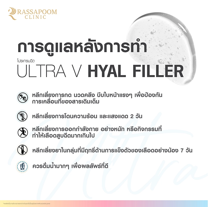 Ultra V Hyal Filler