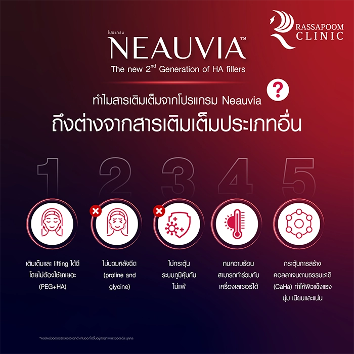 Neauvia ฟิลเลอร์