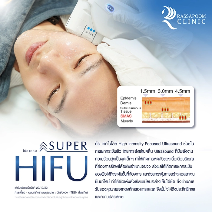 SUPER HIFU