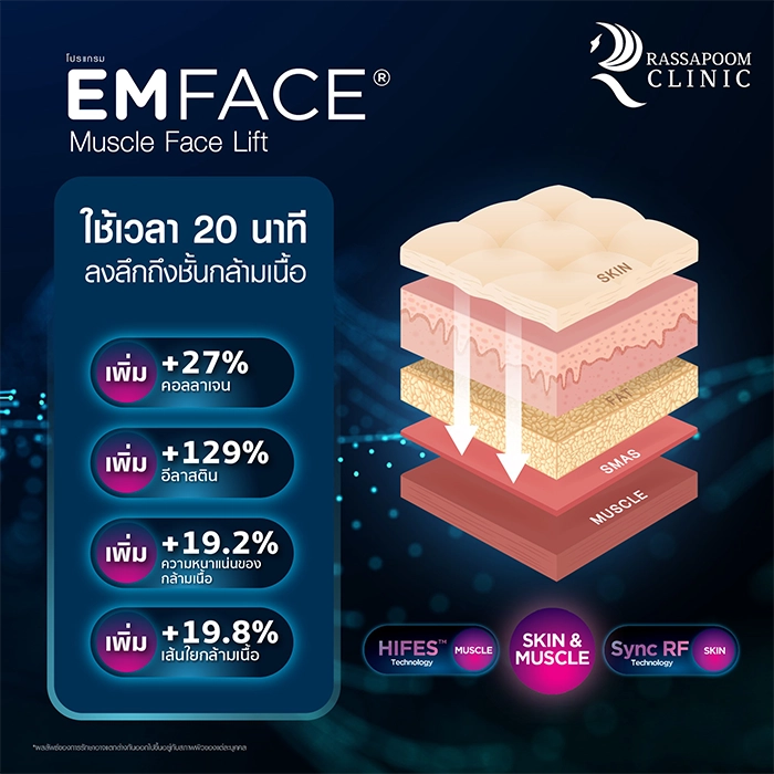 EMFACE คุณนาเดีย วิชิตา โสณกุล