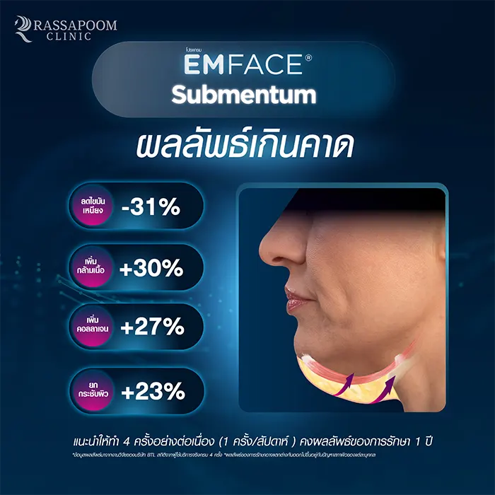 EMFACE Submentum ลดเหนียง