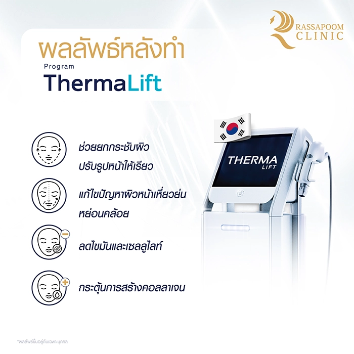 ThermaLift