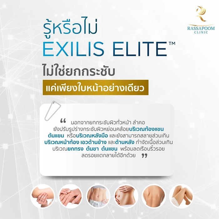 Exilis Ultra 360