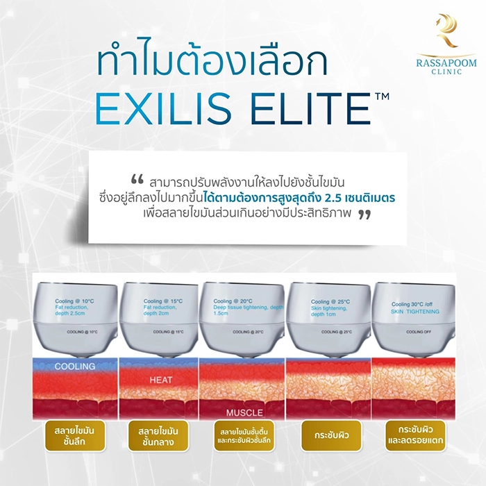 Exilis Ultra 360