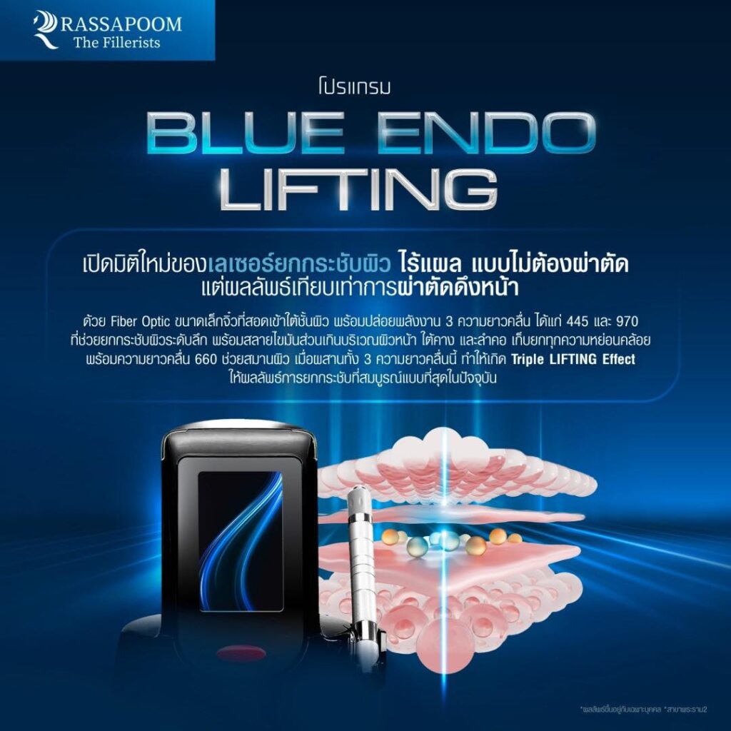 Blue Endo Lifting ทำงานอย่างไร?