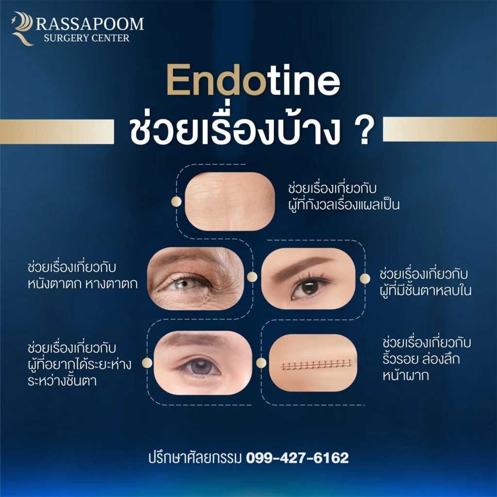 โปรแกรมดึงหน้า Endotine ช่วยเรื่องอะไรบ้าง