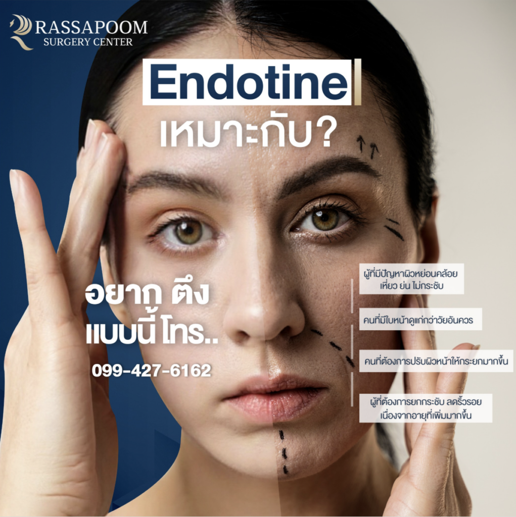 โปรแกรมดึงหน้า Endotine เหมาะกับใคร? โปรแกรมดึงหน้า Endotine แก้ปัญหาผิวหน้าหย่อนคล้อย ด้วยหมุด Endotine 