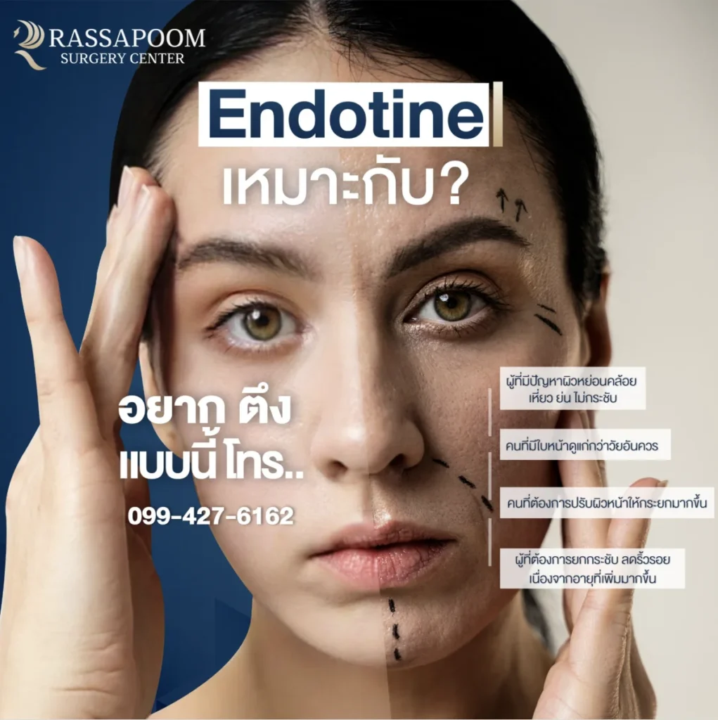โปรแกรมการดึงหน้า Endotine การยกกระชับดึงใบหน้าด้วยหมุด Endotine เหมาะกับ ผู้ที่มีปัญหาผิวหย่อนคล้อย เหี่ยว ย่น ใบหน้าไม่กระชับ