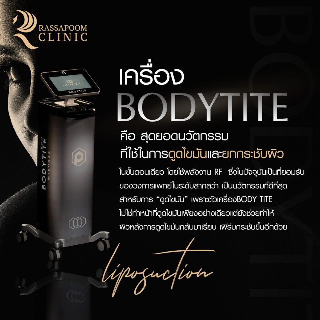 ดูดไขมันต้นแขน Bodytite