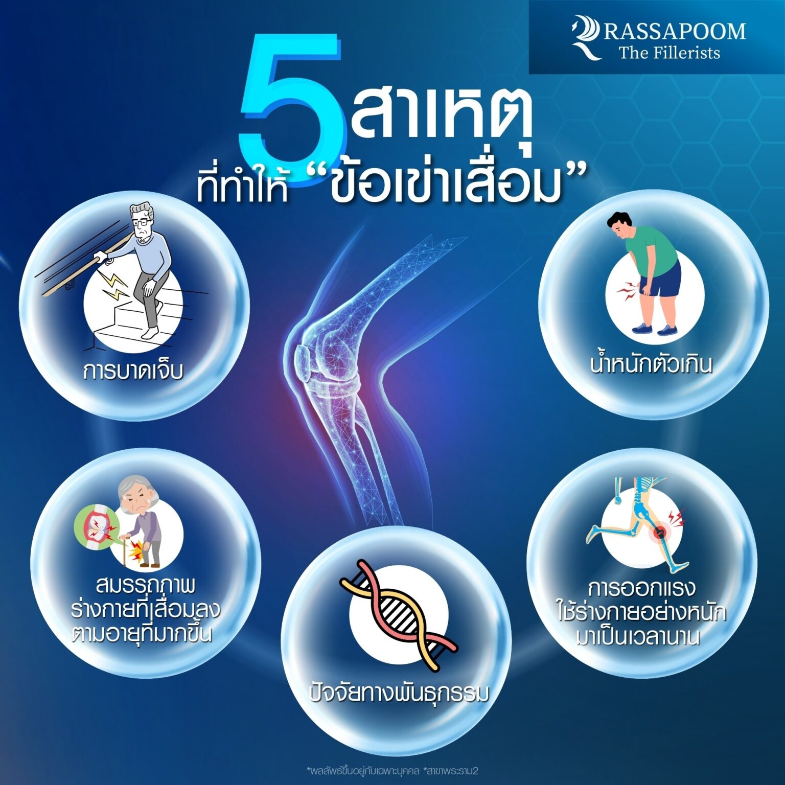 สาเหตุของโรคข้อเข่าเสื่อม