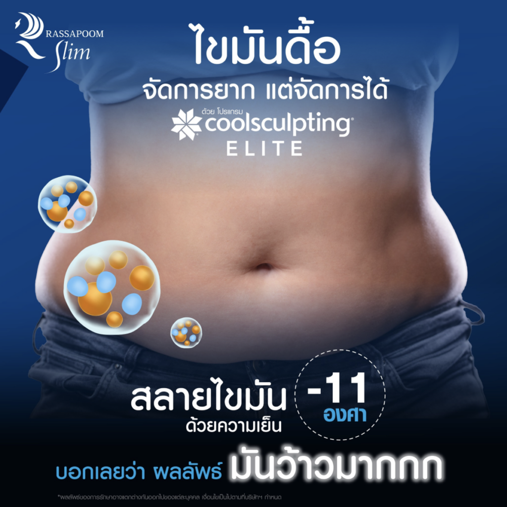 โปรแกรม Coolsculpting ELITE