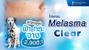 โปรแกรม Melasma Clear