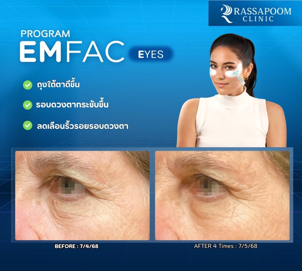 รีวิวโปรแกรม Em face eye