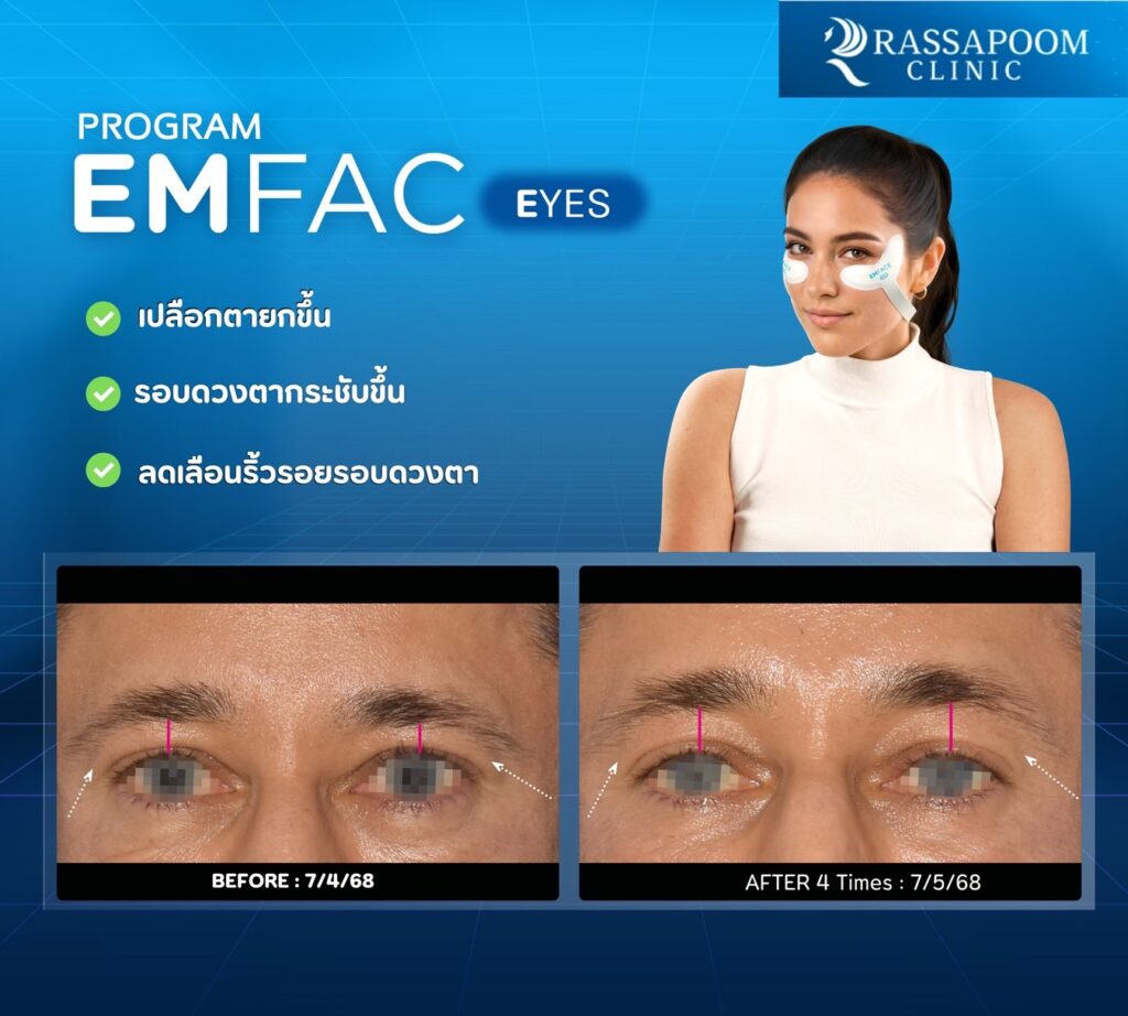 รีวิวโปรแกรม Em face eye