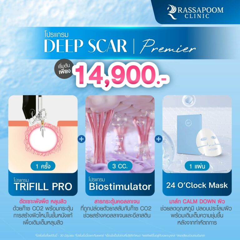 Deep Scar ตัดพังผืด เติมเต็มหลุมสิว สลายทุกวงจรหลุม​