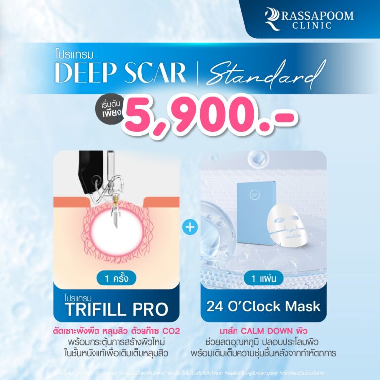 Deep Scar ตัดพังผืด เติมเต็มหลุมสิว สลายทุกวงจรหลุม​