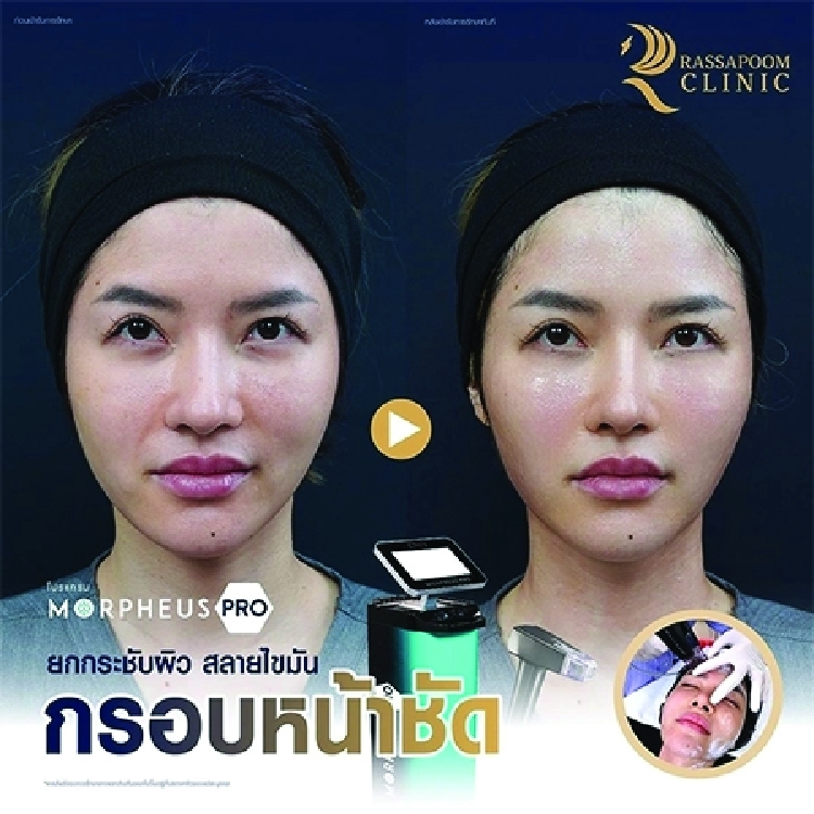 รีวิว morpheus