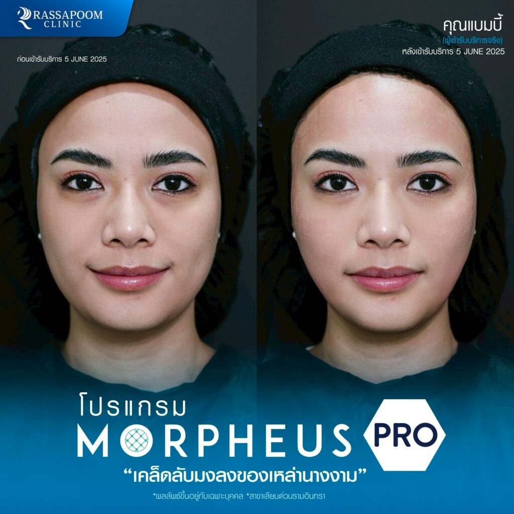 รีวิว morpheus