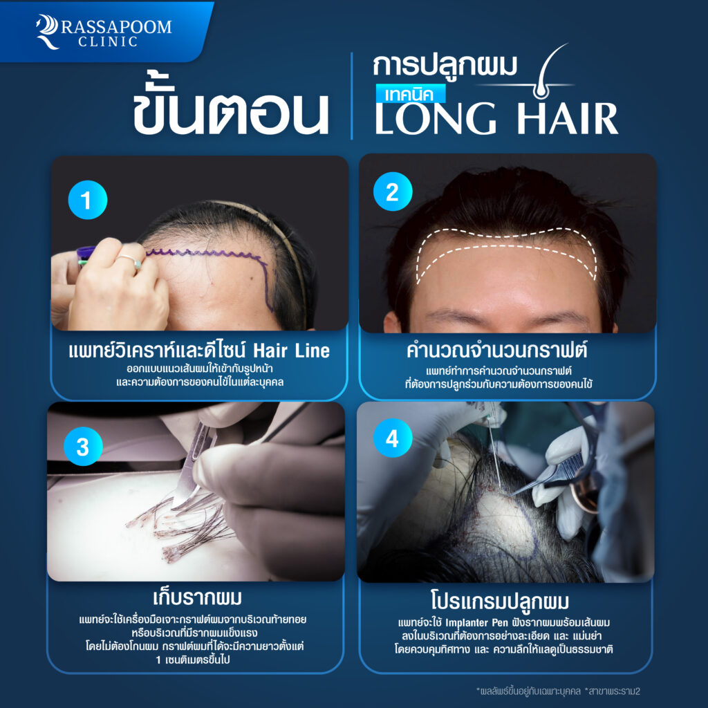 ขั้นตอนโปรแกรมปลูกผม long hair